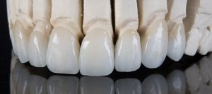 زیرکونیوم و بلوک زیرکونیا