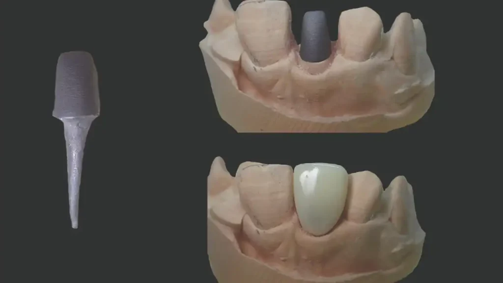 مواد پرینت سه بعدی در دندانپزشکی